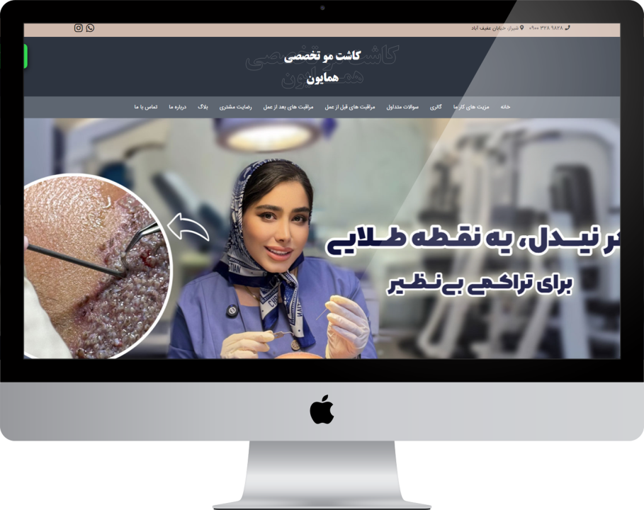 کاشت مو تخصصی همایون